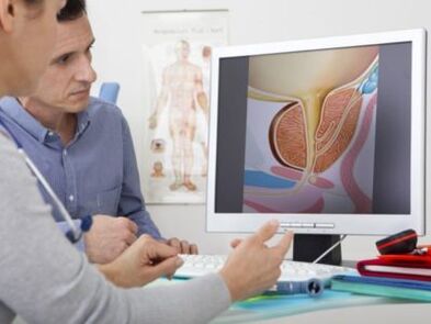 Un urologue consulte un patient au sujet de problèmes de puissance
